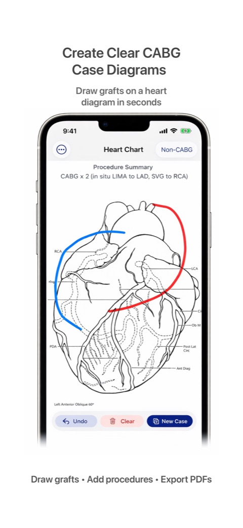 HeartChart screenshot 1